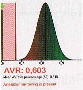reimann_flyer_kurve